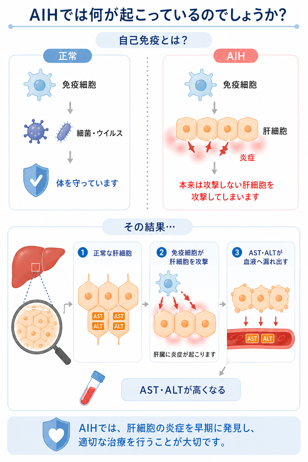 ①AIH