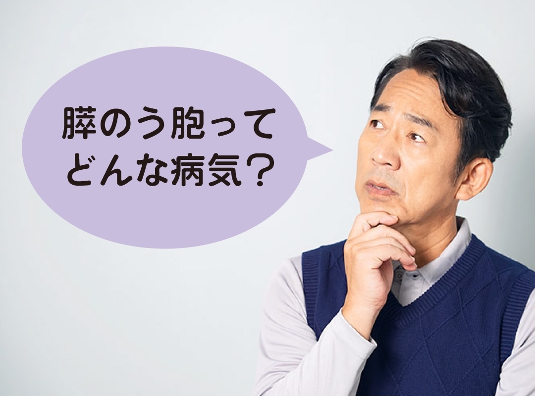 膵のう胞ってどんな病気？