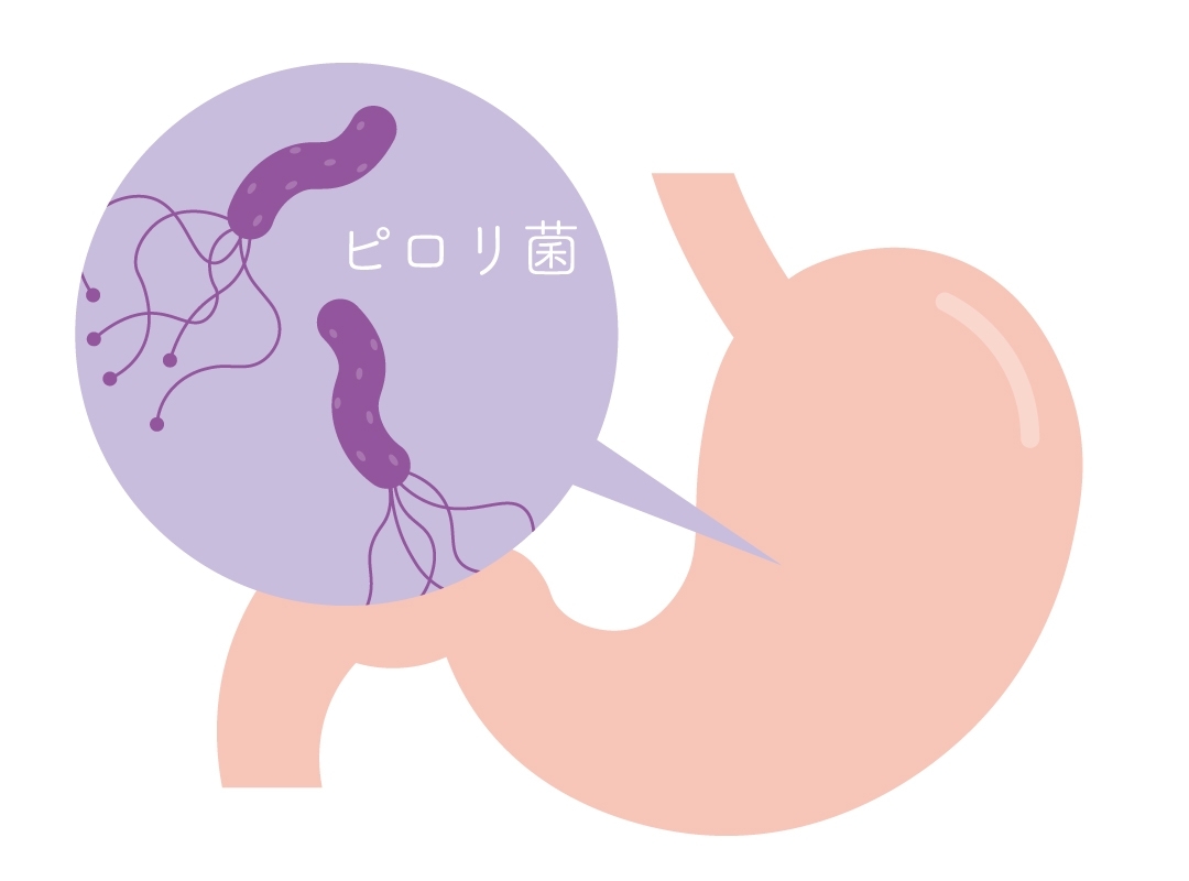 ピロリ菌