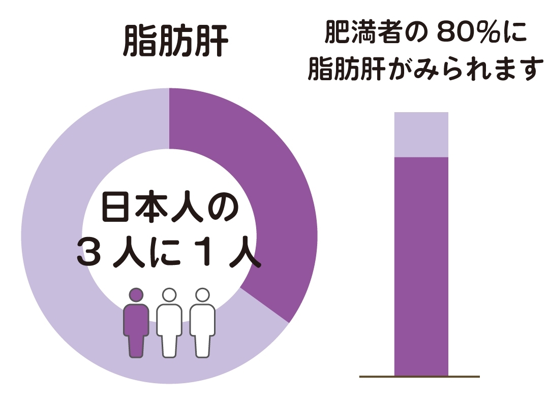 今や日本人の3人に1人が脂肪肝と言われており、肥満者の80％に脂肪肝がみられます。