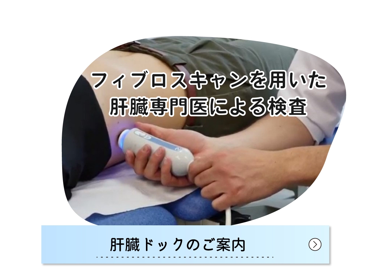 肝臓ドックのご案内